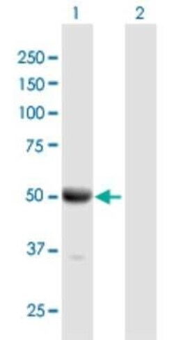 DOC2B Antibody, Novus Biologicals 50 &mu;g | Buy Online | Novus Biologicals | Fisher Scientific