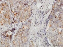 DOCK4 Antibody (3E7), Novus Biologicals 100 &mu;g | Buy Online | Novus Biologicals | Fisher Scientific