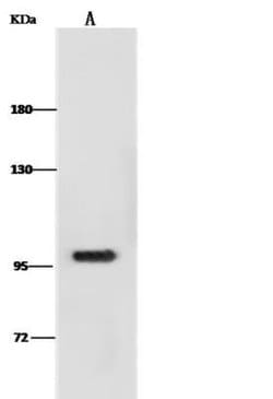 DOG1/TMEM16A Rabbit anti-Human, Clone: 6, Novus Biologicals 100 &mu;g;