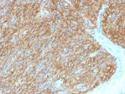 DOG1/TMEM16A Antibody (DG1/1486), Novus Biologicals 20&mu;g; Unlabeled:Antibodies,