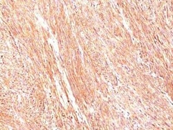 DOG1/TMEM16A Antibody (DG1/447), Novus Biologicals 0.02mg; Unlabeled:Antibodies,