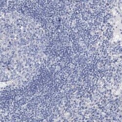 DOG1/TMEM16A Antibody, Novus Biologicals 0.1 mL; Unconjugated:Antibodies,