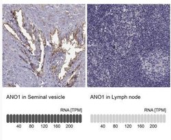 DOG1/TMEM16A Antibody, Novus Biologicals:Antibodies:Primary Antibodies
