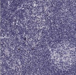 DOG1/TMEM16A Antibody, Novus Biologicals:Antibodies:Primary Antibodies