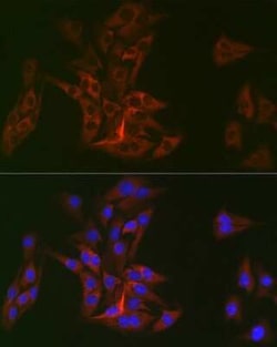 DOK1 Rabbit anti-Human, Mouse, Rat, Clone: 6U4U9, Novus Biologicals 20 &mu;g | Buy Online | Novus Biologicals | Fisher Scientific