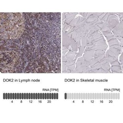 DOK2 Antibody, Novus Biologicals:Antibodies:Primary Antibodies