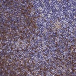 DOK3 Antibody, Novus Biologicals:Antibodies:Primary Antibodies