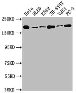 DOT1L Antibody (3B6), Novus Biologicals 100 &mu;g | Buy Online | Novus Biologicals | Fisher Scientific