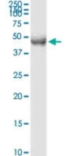 DP2 Antibody (2E6), Novus Biologicals 0.1 mg | Buy Online | Novus Biologicals | Fisher Scientific