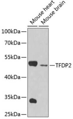 DP2 Antibody - BSA Free, Novus Biologicals 0.02 mL, Unconjugated:Antibodies,