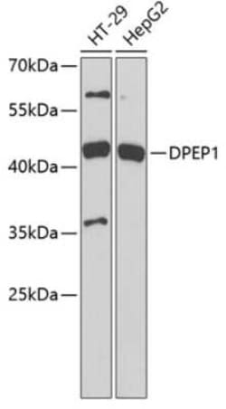 DPEP1 Antibody - BSA Free, Novus Biologicals 0.1 mL, Unconjugated:Antibodies,