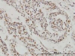 DPF2 Antibody (2F6), Novus Biologicals 0.1 mg | Buy Online | Novus Biologicals | Fisher Scientific