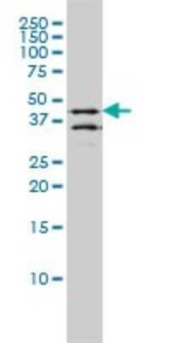 DPF2 Antibody (2F6), Novus Biologicals 0.1 mg | Buy Online | Novus Biologicals | Fisher Scientific