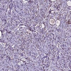 DPF3 Antibody, Novus Biologicals:Antibodies:Primary Antibodies