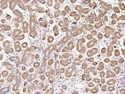 DPF3 Antibody, Novus Biologicals 100 &mu;g | Buy Online | Novus Biologicals | Fisher Scientific