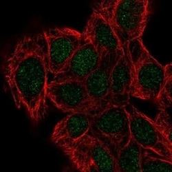 DPH2 Antibody, Novus Biologicals 25 &mu;L; Unconjugated:Antibodies, Polyclonal