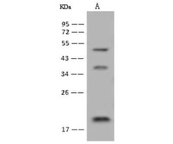 DPH4 Antibody, Novus Biologicals 100 &mu;g, Unconjugated:Antibodies, Polyclonal