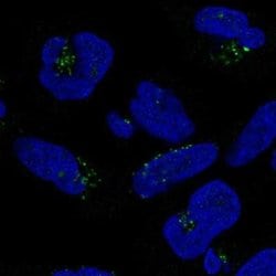 DPH5 Antibody, Novus Biologicals DPH5 Antibody; Unconjugated; 100 &mu;L:Antibodies,