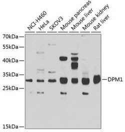 DPM1 Antibody - BSA Free, Novus Biologicals 0.02 mL, Unconjugated:Antibodies,