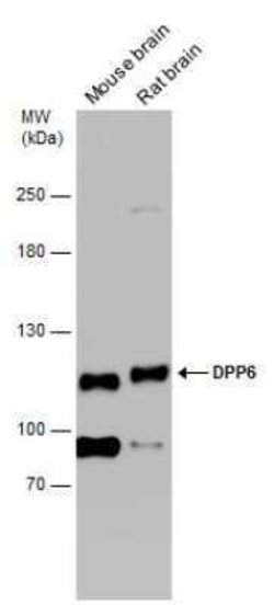 DPP6 Antibody, Novus Biologicals 100 &mu;g | Buy Online | Novus Biologicals | Fisher Scientific