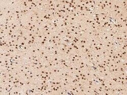 DPPA2 Antibody, Novus Biologicals 100 &mu;g, Unconjugated:Antibodies, Polyclonal