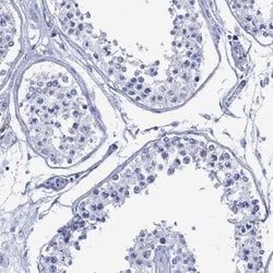 DPPIV/CD26 Rabbit anti-Human, Polyclonal, Novus Biologicals 100 &mu;g | Buy Online | Novus Biologicals | Fisher Scientific