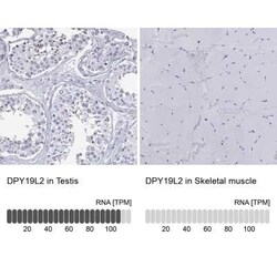 DPY19L2 Rabbit anti-Human, Polyclonal, Novus Biologicals:Antibodies:Primary