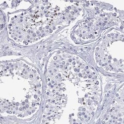 DPY19L2 Rabbit anti-Human, Polyclonal, Novus Biologicals:Antibodies:Primary