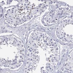DPY19L2 Rabbit anti-Human, Polyclonal, Novus Biologicals:Antibodies:Primary