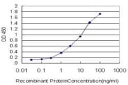 DPYD Antibody (7D4), Novus Biologicals 0.1 mg, Unconjugated:Antibodies,