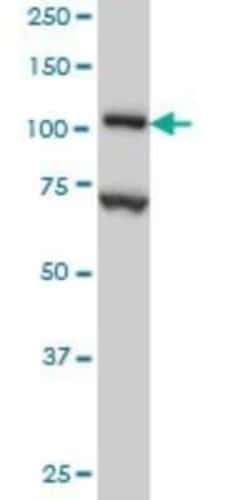 DPYD Antibody (7D4), Novus Biologicals 0.1 mg, Unconjugated:Antibodies,