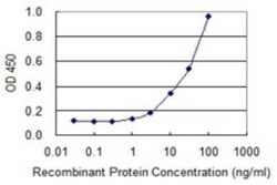 DPYSL4 Antibody (1F5), Novus Biologicals 0.1 mg | Buy Online | Novus Biologicals | Fisher Scientific