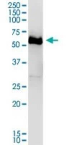 DPYSL4 Antibody, Novus Biologicals 0.05 mg | Buy Online | Novus Biologicals | Fisher Scientific