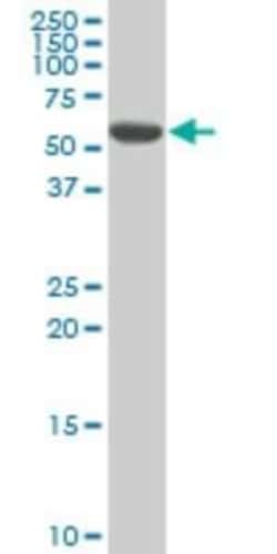 DRAK1 Antibody (3G8), Novus Biologicals 0.1 mg | Buy Online | Novus Biologicals | Fisher Scientific