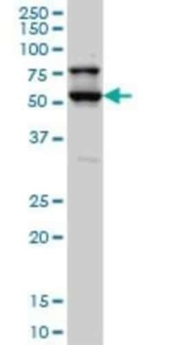 DRAK1 Antibody (4D12), Novus Biologicals 0.1 mg | Buy Online | Novus Biologicals | Fisher Scientific