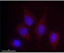 DRAM Antibody (M3-P4B4) - BSA Free, Novus Biologicals 0.1 mL, Unconjugated:Antibodies,