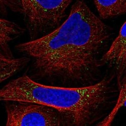 DRAM2 Antibody, Novus Biologicals:Antibodies:Primary Antibodies