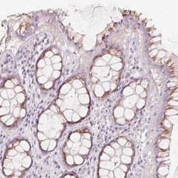DRAM2 Antibody, Novus Biologicals:Antibodies:Primary Antibodies