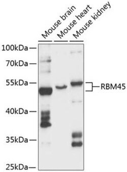 DRB1 Antibody - Azide and BSA Free, Novus Biologicals:Antibodies:Primary