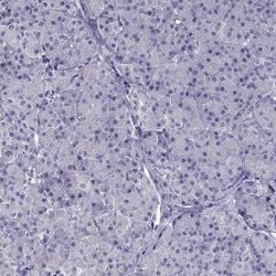 DRIL1 Antibody, Novus Biologicals 0.1 mL | Buy Online | Novus Biologicals | Fisher Scientific