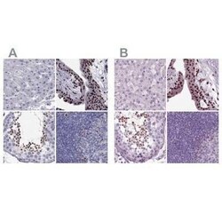 DRIL1 Antibody, Novus Biologicals 0.1 mL | Buy Online | Novus Biologicals | Fisher Scientific
