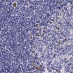 DRIL1 Antibody, Novus Biologicals 0.1 mL | Buy Online | Novus Biologicals | Fisher Scientific