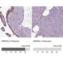 DRIL1 Antibody, Novus Biologicals 25ul; Unconjugated:Antibodies, Polyclonal
