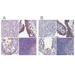 DRIL1 Antibody, Novus Biologicals 25ul; Unconjugated:Antibodies, Polyclonal