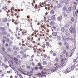 DRIL1 Antibody, Novus Biologicals 25ul; Unconjugated:Antibodies, Polyclonal