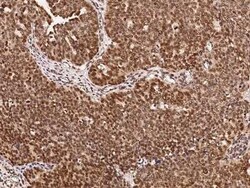 DRIL1 Antibody, Novus Biologicals 50 &mu;g, Unconjugated:Antibodies, Polyclonal