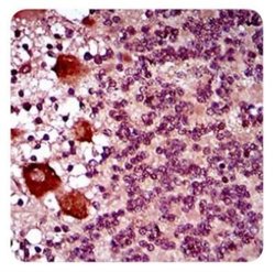 DRP1 Antibody (4E11B11) - Azide and BSA Free, Novus Biologicals 0.1 mL;