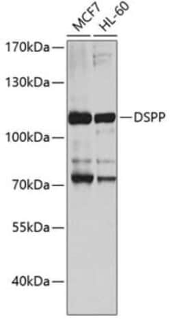 DSPP Antibody - Azide and BSA Free, Novus Biologicals 0.02 mL | Buy Online | Novus Biologicals | Fisher Scientific