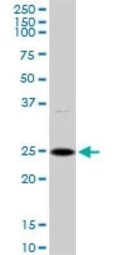 DSU Antibody, Novus Biologicals 0.1 mg | Buy Online | Novus Biologicals | Fisher Scientific