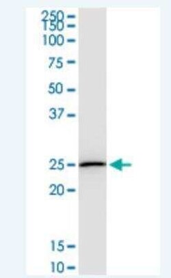 DTYMK Antibody (2G11), Novus Biologicals 100 &mu;g | Buy Online | Novus Biologicals | Fisher Scientific
